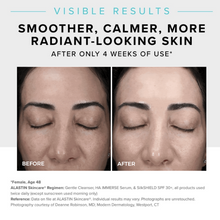 Load image into Gallery viewer, Alastin HA Immerse Serum
