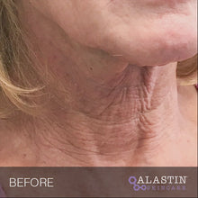 Load and play video in Gallery viewer, Alastin Restorative Neck Complex
