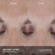 Load and play video in Gallery viewer, Alastin Renewal Retinol 0.5%
