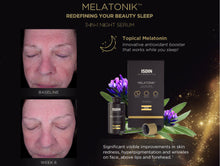 Load image into Gallery viewer, Melatonik - Redefining Your Beauty Sleep

