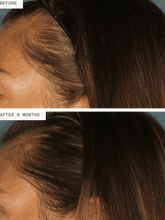 Load image into Gallery viewer, Nutrafol Hair Growth Supplement for Women 3mo Supply
