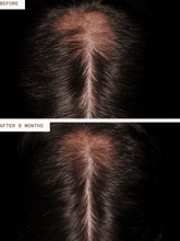 Load image into Gallery viewer, Nutrafol Hair Growth Supplement for Men 3mo Supply
